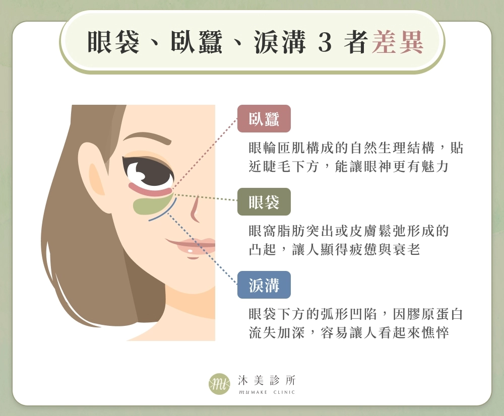 眼袋、臥蠶、淚溝 3 者差異
