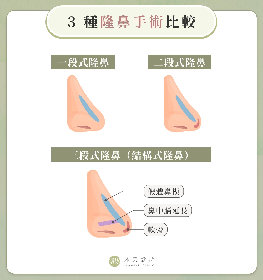 3種隆鼻手術比較