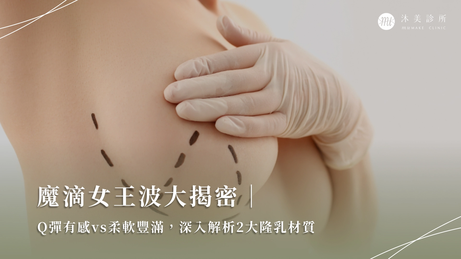 魔滴女王波大揭密|Q彈有感vs柔軟豐滿,深入解析2大隆乳材質
