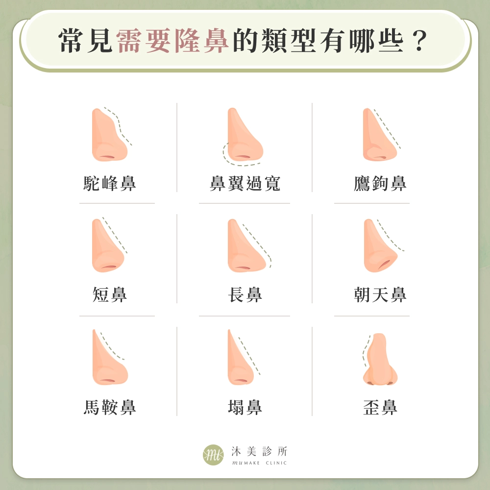 常見需要隆鼻的類型有哪些?