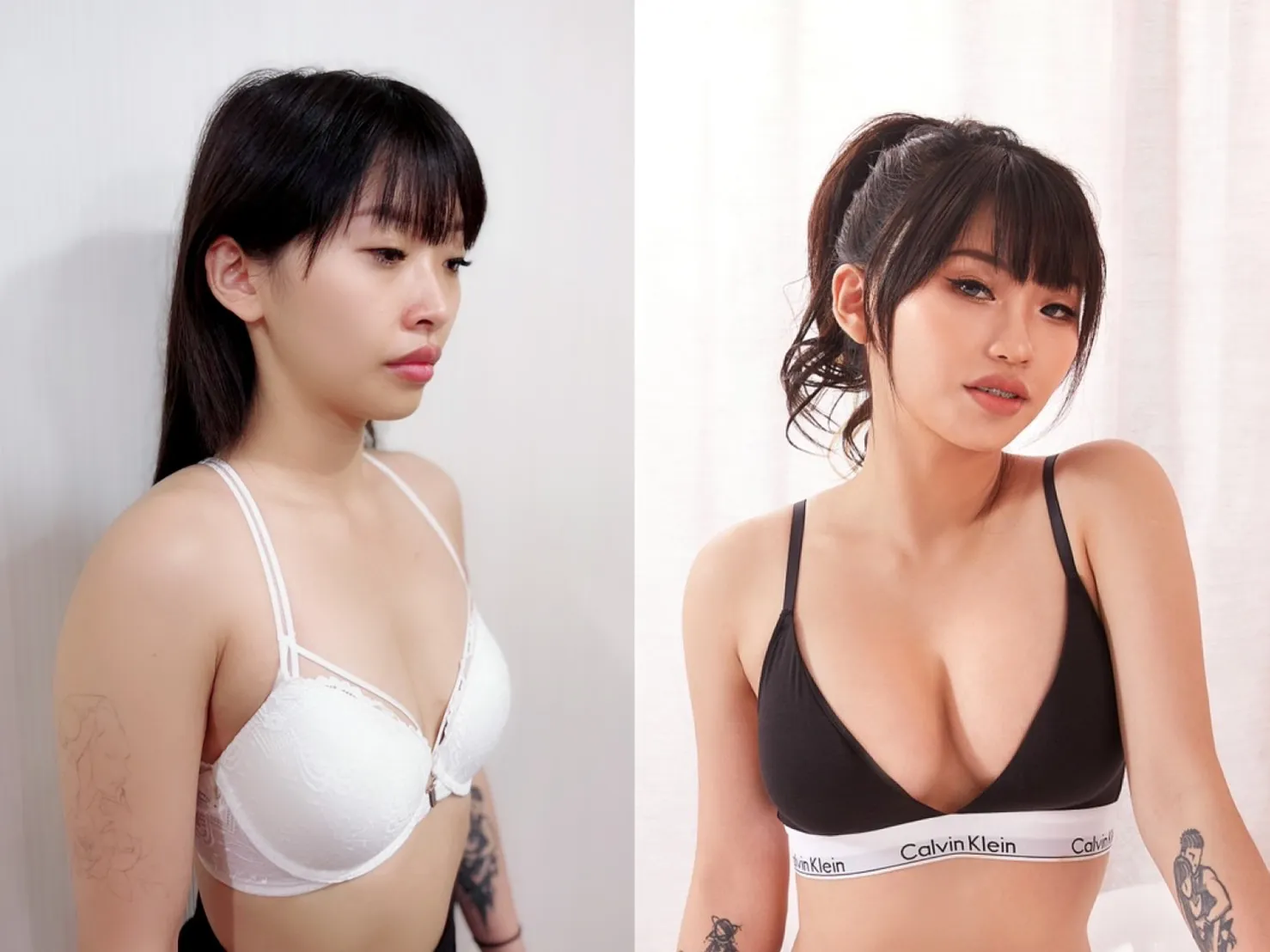 術後真實案例分享｜Before & After