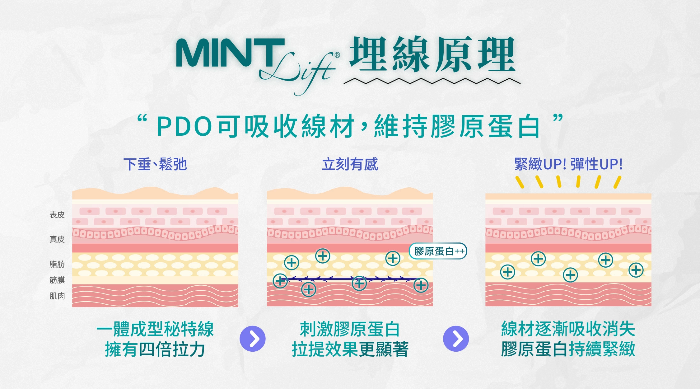 MINT Lift 秘特神力拉提線
