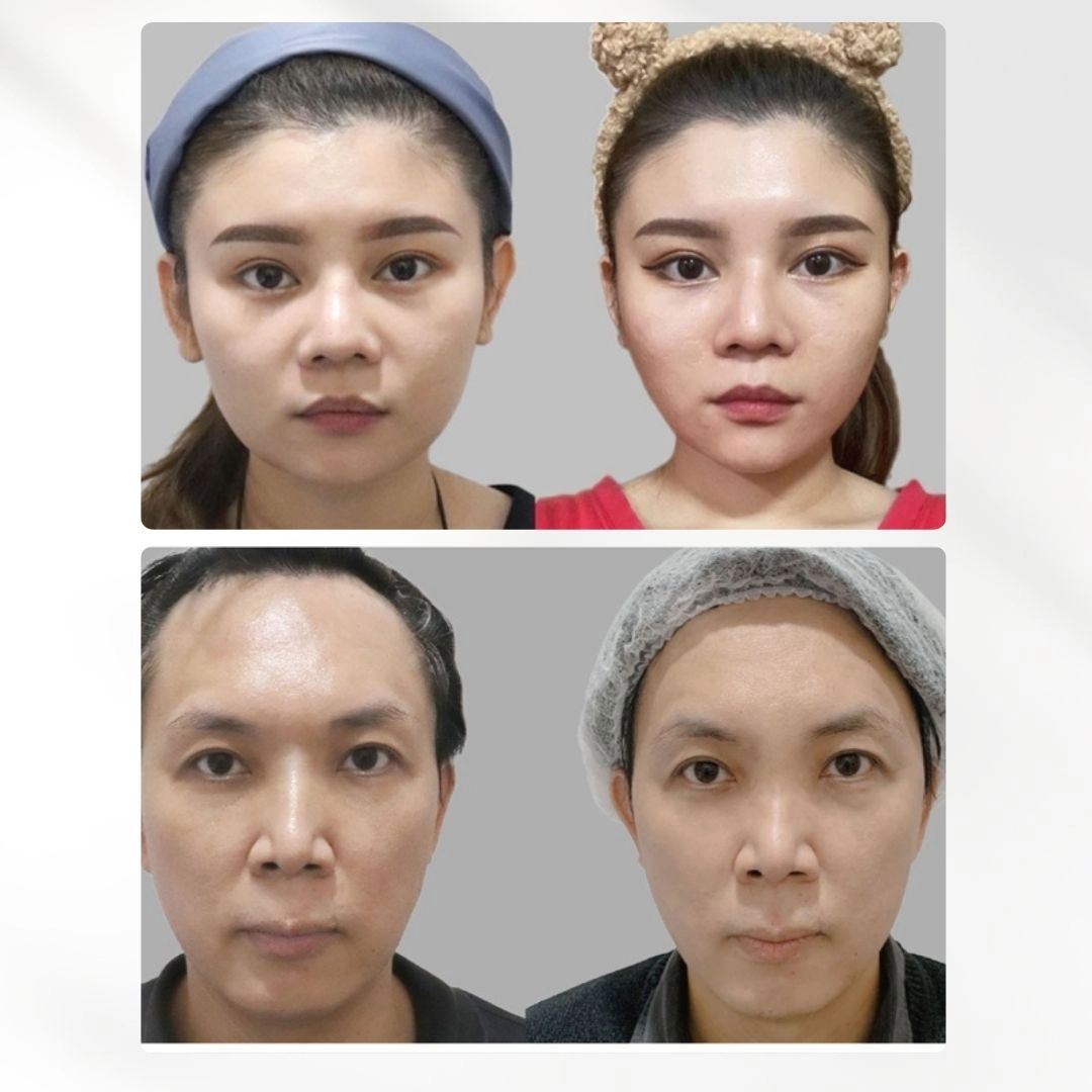 MINT Lift 秘特神力拉提線